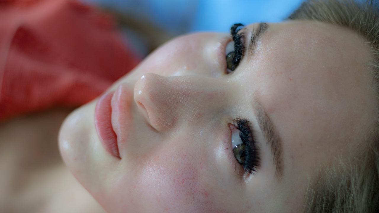 riduri frunte botox